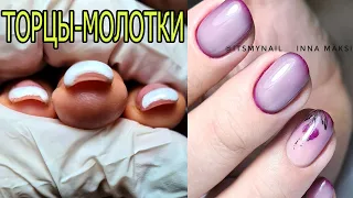 ❤ ТОРЦЫ - МОЛОТКИ ❤ работа другого мастера ❤ ПРЕОБРАЖЕНИЕ ногтей ❤ #nails #innamaksimova