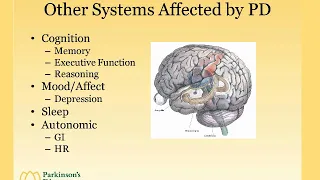 Expert Briefing Webinar: Parkinson’s: Swallowing and Dental Challenges