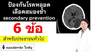 ป้องกันโรคหลอดเลือดสมองเกิดซ้ำ ทำอย่างไร : Secondary stroke prevention