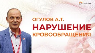 Нарушение кровообращения. Опасные последствия | Огулов А.Т.