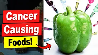 21 Cancer Causing Foods Proven To Kill You! Avoid These Cancer Foods!