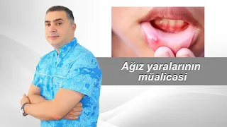 Ağız yaralarının müalicəsi