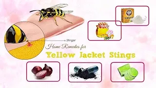 How to Treat Yellow Jacket Stings | Treatment, Allergic Reaction, Prevention.