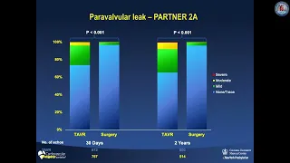 Over 15 years: the advancement of transcatheter aortic valve replacement