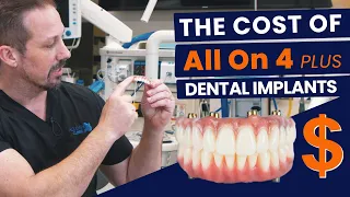 True Cost of All On 4 Plus® Dental Implants
