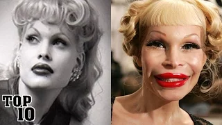 Top 10 Extreme Plastic Surgery Disasters - Part 2