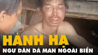 Đã xác định được ba nghi can hành hạ dã man hai ngư dân trên tàu ở Cà Mau