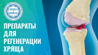 Какие препараты восстанавливают хрящ? Хондропротекторы эффективность, антиоксиданты, антикоагулянты