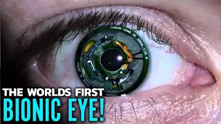 Bionic Eyes An Eye That Can Help The Blind || Advanced Technology To See The Future