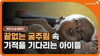 [영양실조 아동 돕기] 기적을 기다리는 아이들