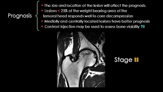 Radiology Course Dr Mamdouh Mahfouz Hip joint