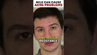 Milk Can Cause Acne Problems! Here is why