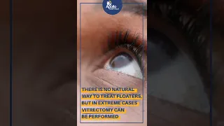 How to reduce floaters in the eyes? | Apollo Hospitals