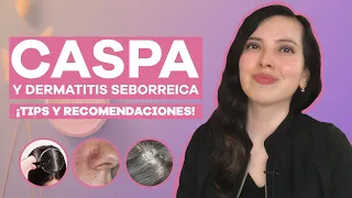 CASPA? Dermatitis seborreica, lo que tienes que saber