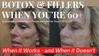 Botox & Filler Over 60: When It Works & When It Just Doesn't Cut It Anymore