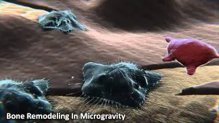 Bone Remodeling in Microgravity