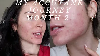 My accutane journey (round 2): Month 2