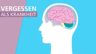 Alzheimer: Die häufigste From von Demenz | Stiftung Gesundheitswissen