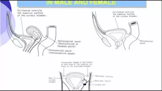 13 Pelvis Urinary Bladder