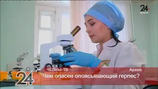 Чем опасен опоясывающий герпес?