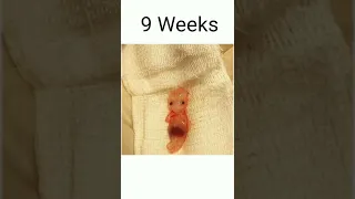 7 Weeks to 10 Weeks pregnancy baby abortions😥#shorts#malayalam #viral #trending #pregnancy