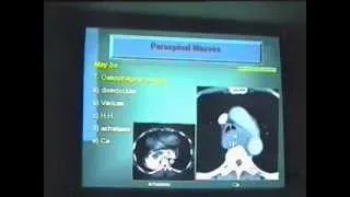 Radiology of the mediastinum in Arabic 2