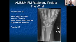 Wrist | MSK Radiology: X-Ray Educational Modules for Primary Care Residents