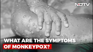 What Is Monkeypox And How Dangerous Is It?