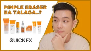 REAL-TALK REVIEW: QuickFX Pimple Eraser | Jan Angelo