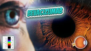 Bevacizumab - Your EYEBALLS - EYNTK 👁️💉😳💊🔊💯✅