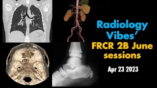 RadVibes FRCR 2B viva sessions - April 23 2023