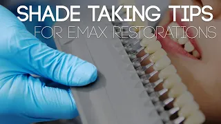 Shade Taking Tips for E.MAX Restorations