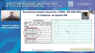 Результаты длительного проспективного наблюдения за пациентами с желудочковыми аритмиями ...