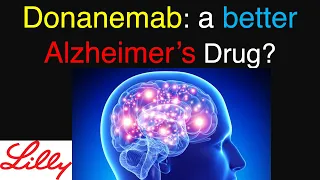 Another Alzheimer’s Drug May Be Coming: Hope or Hype? | Donanemab