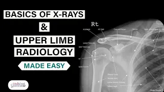 Radiological Anatomy Made Easy| Basics of X-Rays and Upper Limb Radiology