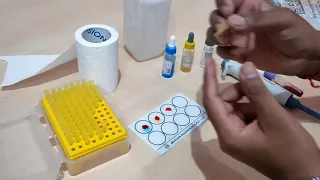 Blood Group test = Procedure Determination of Blood Group. | ब्लड ग्रूप कैसे पता लगाते हैं In hindi