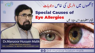 Eye Allergy, Its Prevention and Treatment | Urdu/Hindi