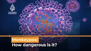 Monkeypox virus outbreak: What’s happening?