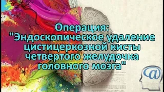 Операция. Эндоскопическое удаление цистицеркозной кисты 4-го желудочка головного мозга Нейрохирургия