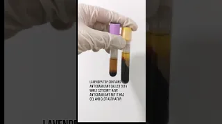 lavender top vs sst tube #laboratory #medtechstudent #cls #mls #lab #vacutainer #plasma #serum