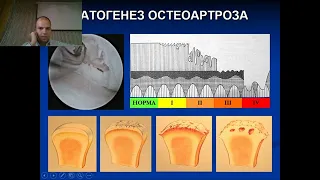 Дегенеративно-дистрофические поражения крупных суставов.