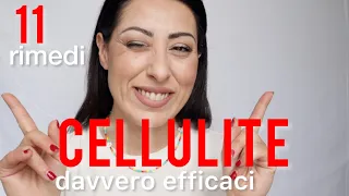 SOS CELLULITE : RIMEDI CHE FUNZIONANO - anche last minute