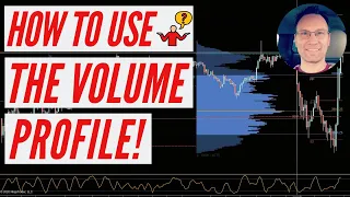 How To Trade With Volume Profile | Day Trading Futures 📈👍