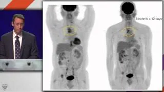 Advantages & Limitations of Integrating Next-Gen Sequencing - Christopher Corless, M.D., Ph.D.