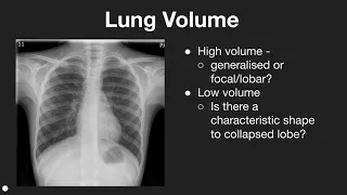 Beginners guide to paediatric chest x-rays