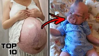 Top 10 Disturbing Things That Made Doctors Go Crazy