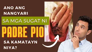 Anong Nangyari sa Mga Sugat Ni Padre Pio Sa Kamatayan Niya?