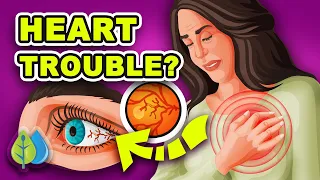 Top 3 Signs of Heart Disease Your Eyes REVEAL (& 5 health problems)