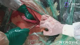 Cesarean section in cattle ( In Uterine torsion)