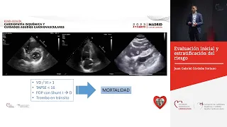 Tromboembolismo pulmonar